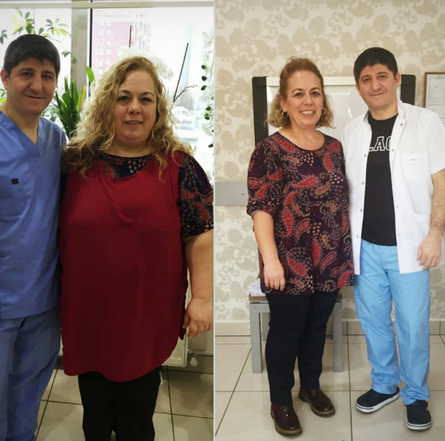 Obezite cerrahisinden önce ve sonra